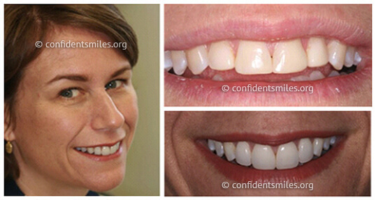 Cosmetic dentistry in West Malling